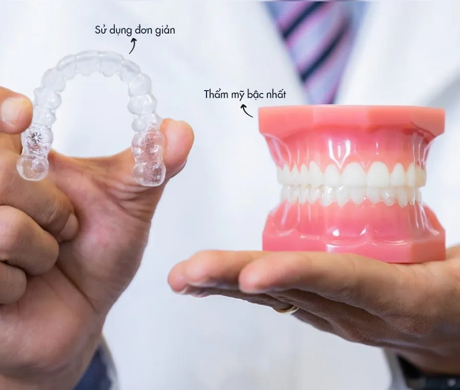 Niềng răng trong suốt là gì