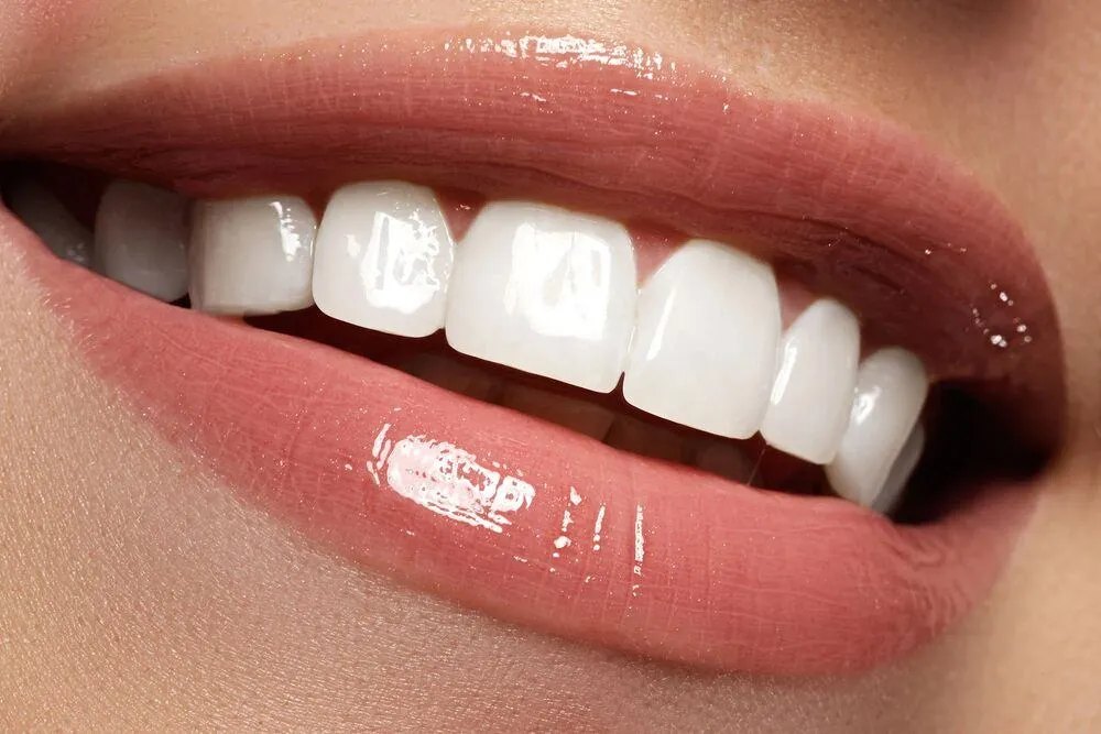 Các loại răng sứ phổ biến