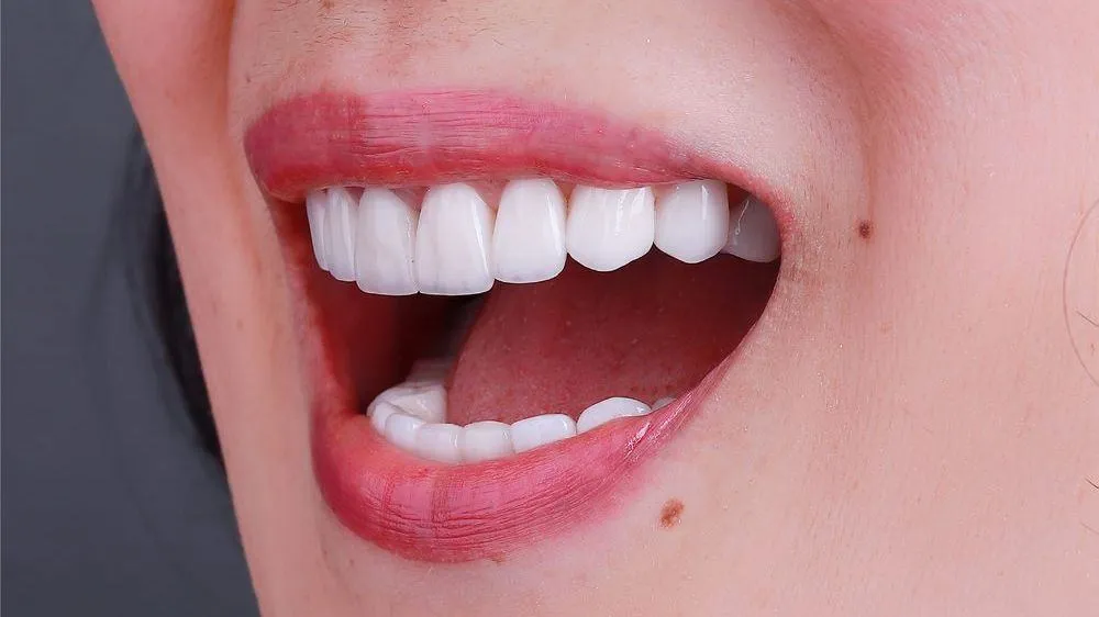nắn chỉnh khớp hàm