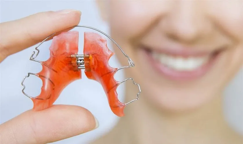 có phải đeo hàm duy trì cả đời không