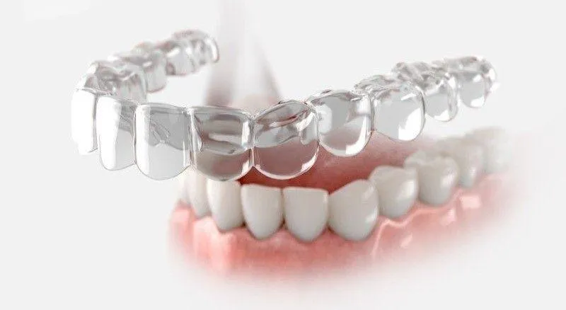 có phải đeo hàm duy trì cả đời không