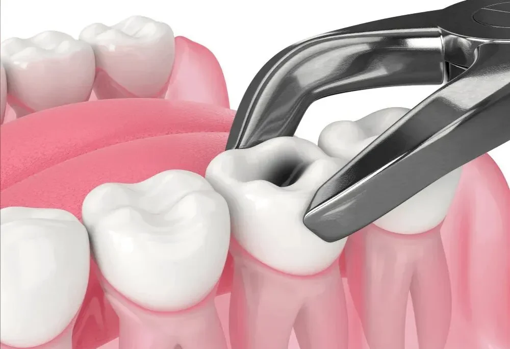 những ngày không nên nhổ răng