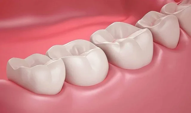 nhổ răng hàm có ảnh hưởng đến thần kinh không