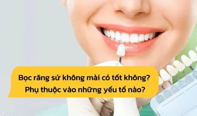 bọc răng sứ không mài
