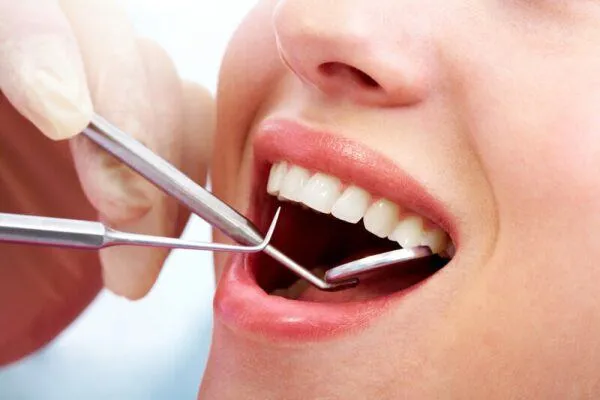 những ngày không nên nhổ răng