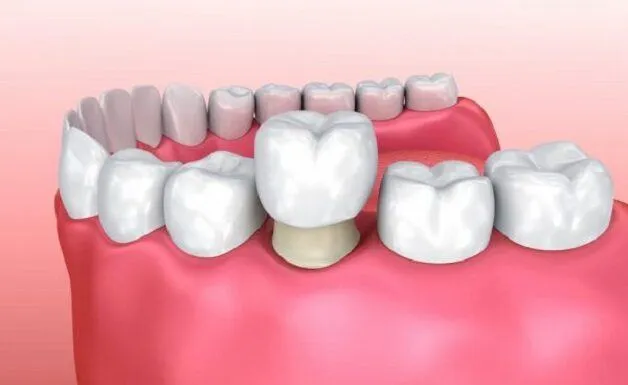 nhổ răng số 7 có bị hóp má không
