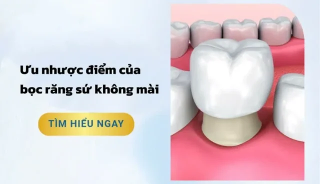bọc răng sứ không mài