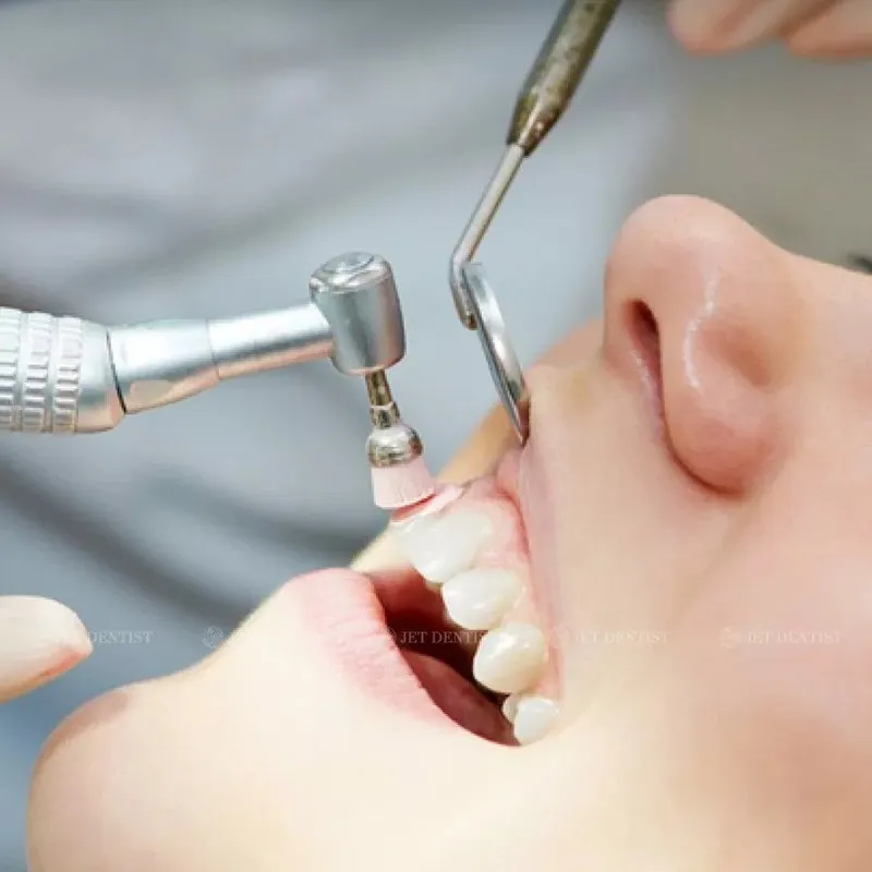 Lấy cao răng có đau không