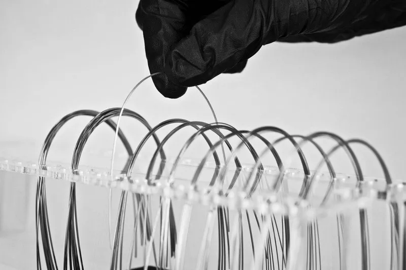 Bao lâu thì thay kích thước dây cung niềng răng