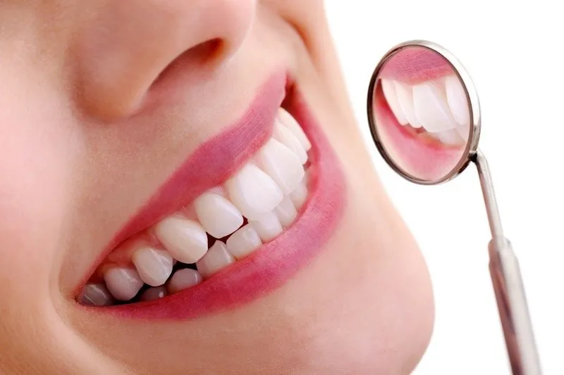Làm răng sứ 4 răng cửa là gì