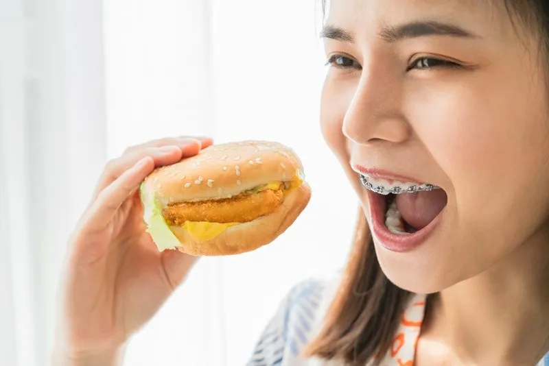 Niềng răng nên kiêng ăn gì