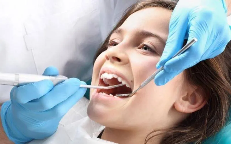 Trẻ em có cần lấy cao răng không?