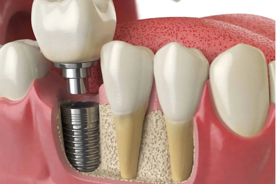 Trình độ và kinh nghiệm của bác sĩ thực hiện