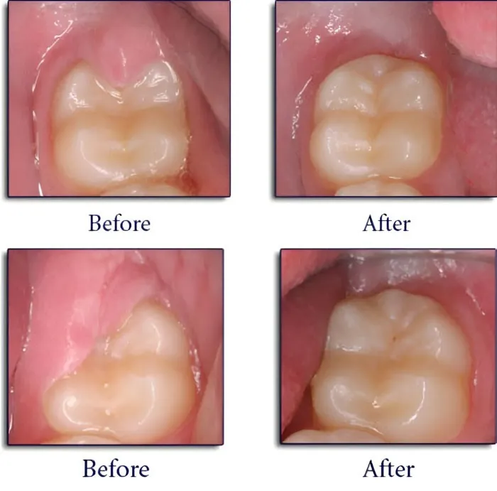 Hẹn lịch tái khám