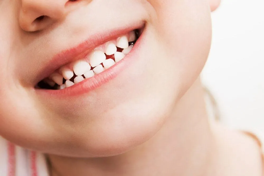 Khi nào răng sữa bắt đầu mọc ở trẻ?