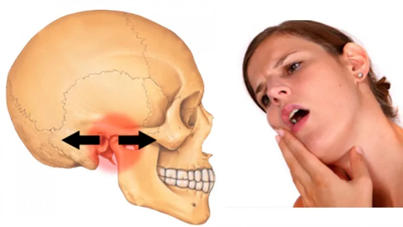 Thế nào là hiện tượng cứng hàm không há miệng được