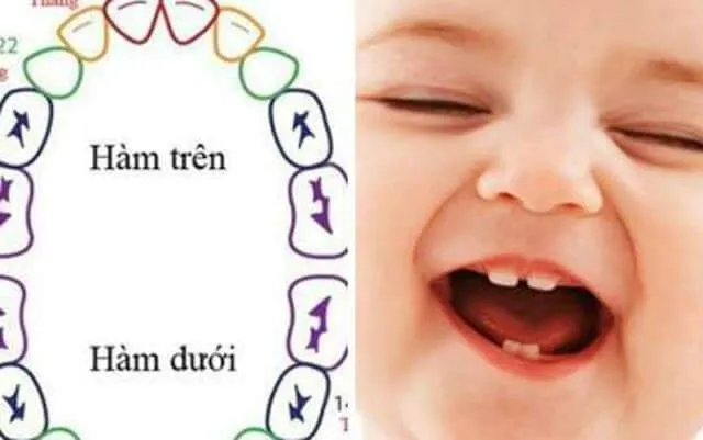 Lịch thay răng sữa của trẻ cha mẹ cần biết
