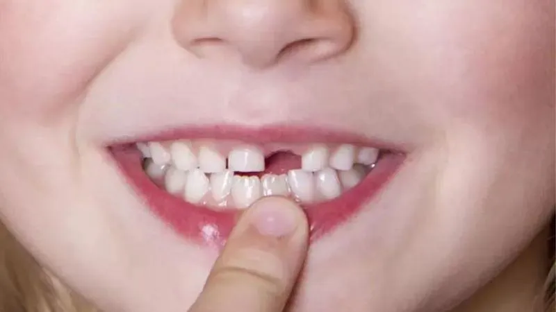 Thứ tự mọc và thay răng diễn ra như thế nào?