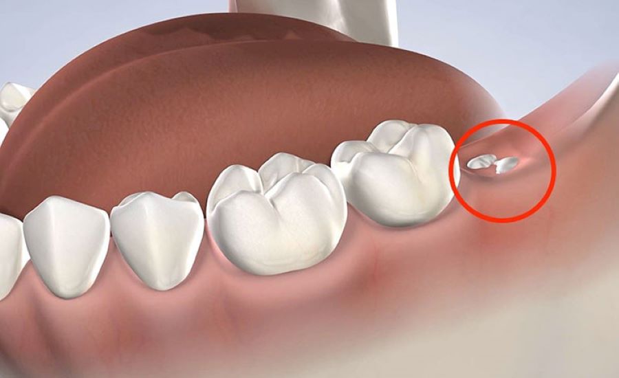 Chân răng là bộ phận nào?