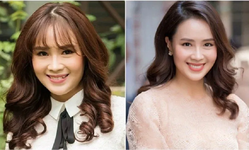 Hàm răng đều đẹp, tạo nụ cười rạng rỡ