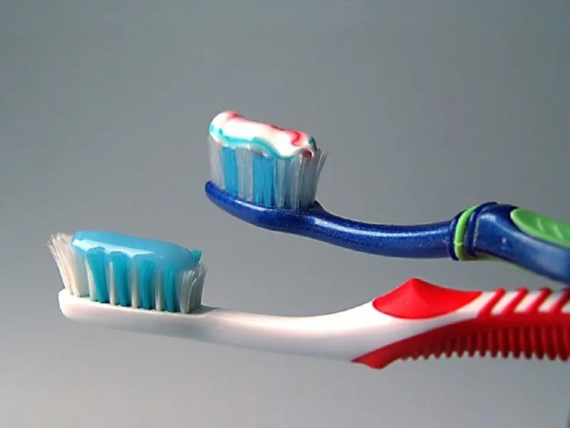 Hướng dẫn vệ sinh răng miệng khi mang mắc cài