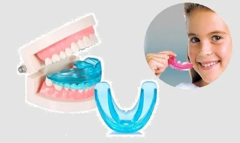 Ưu điểm của niềng răng bằng nhựa silicon