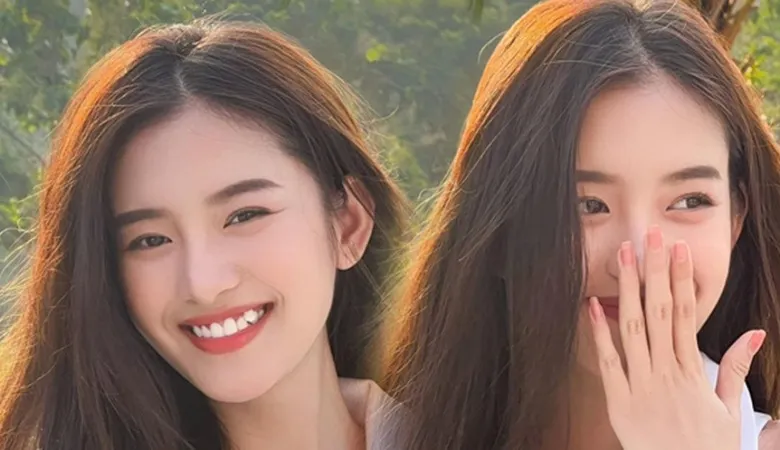 Ảnh hưởng của răng khểnh là gì?