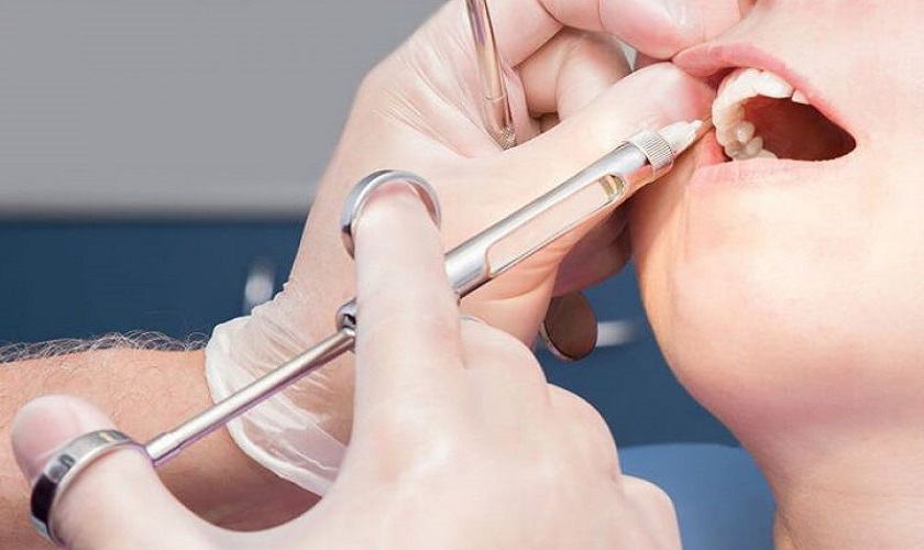 Bước 3: Gây tê và mài cùi răng