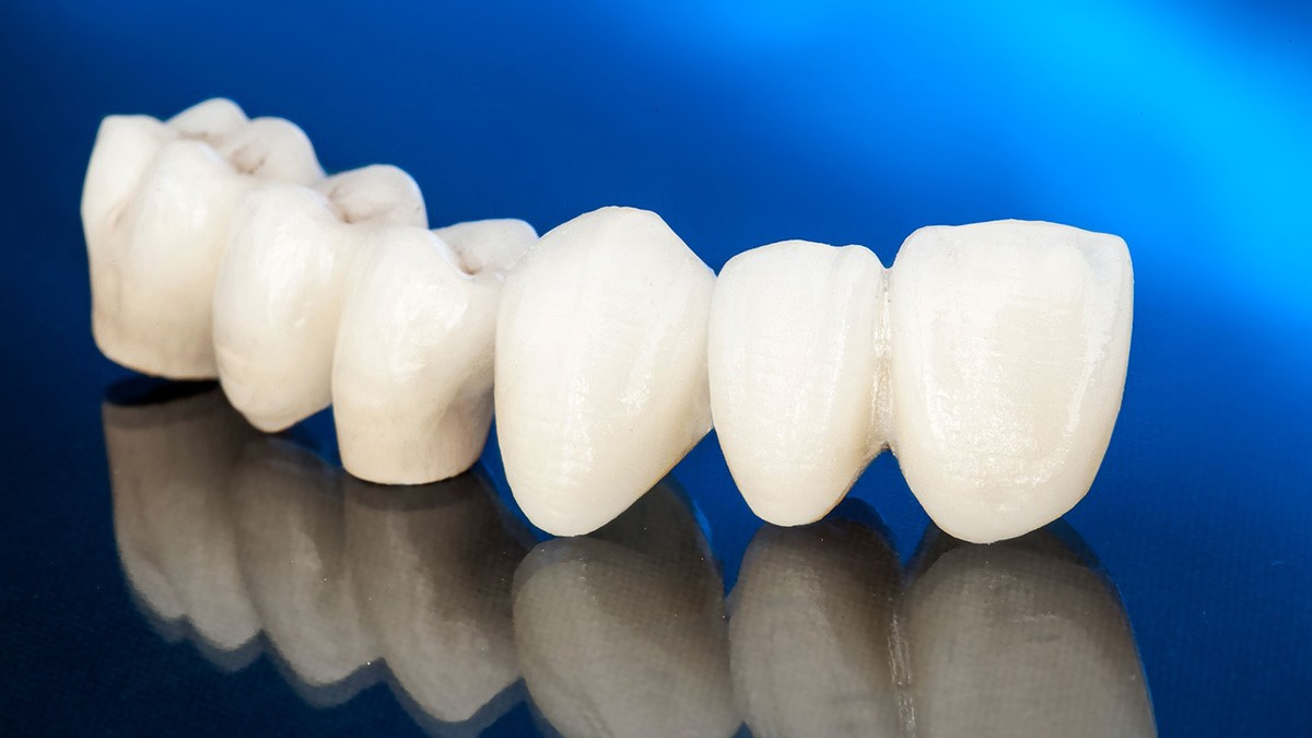 Răng sứ Zirconia
