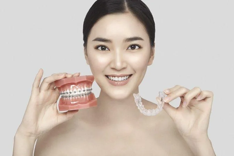 Niềng răng 3D Clear