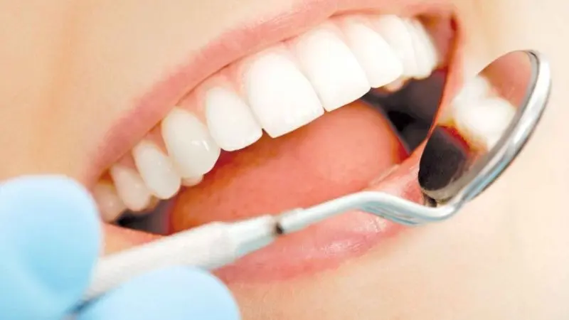 Đặc điểm của cung răng gồm những gì?