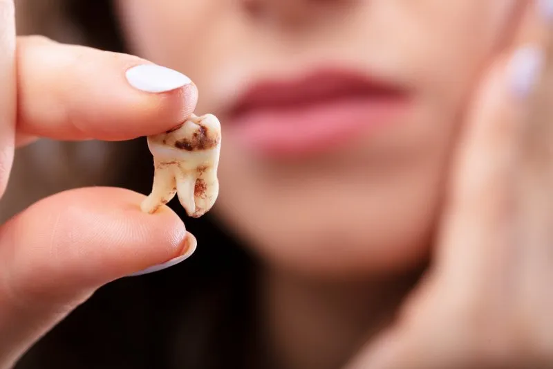 Cảm giác sau khi bọc răng sứ bị chết tủy