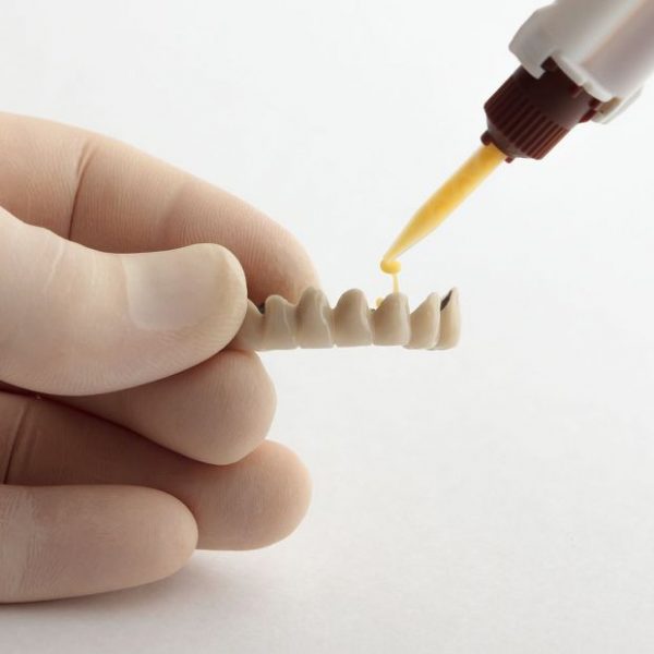Keo dán sứ kém chất lượng dẫn đến răng sứ có vấn đề