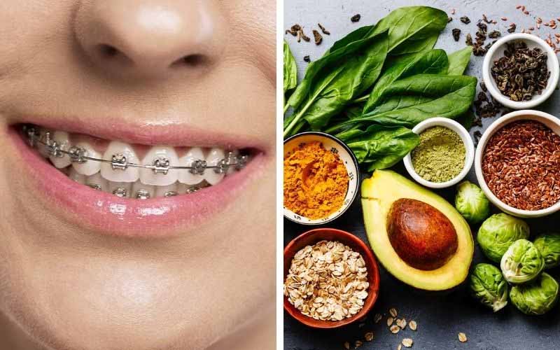 Những lưu ý khi thực hiện kéo cụm 4 răng cửa