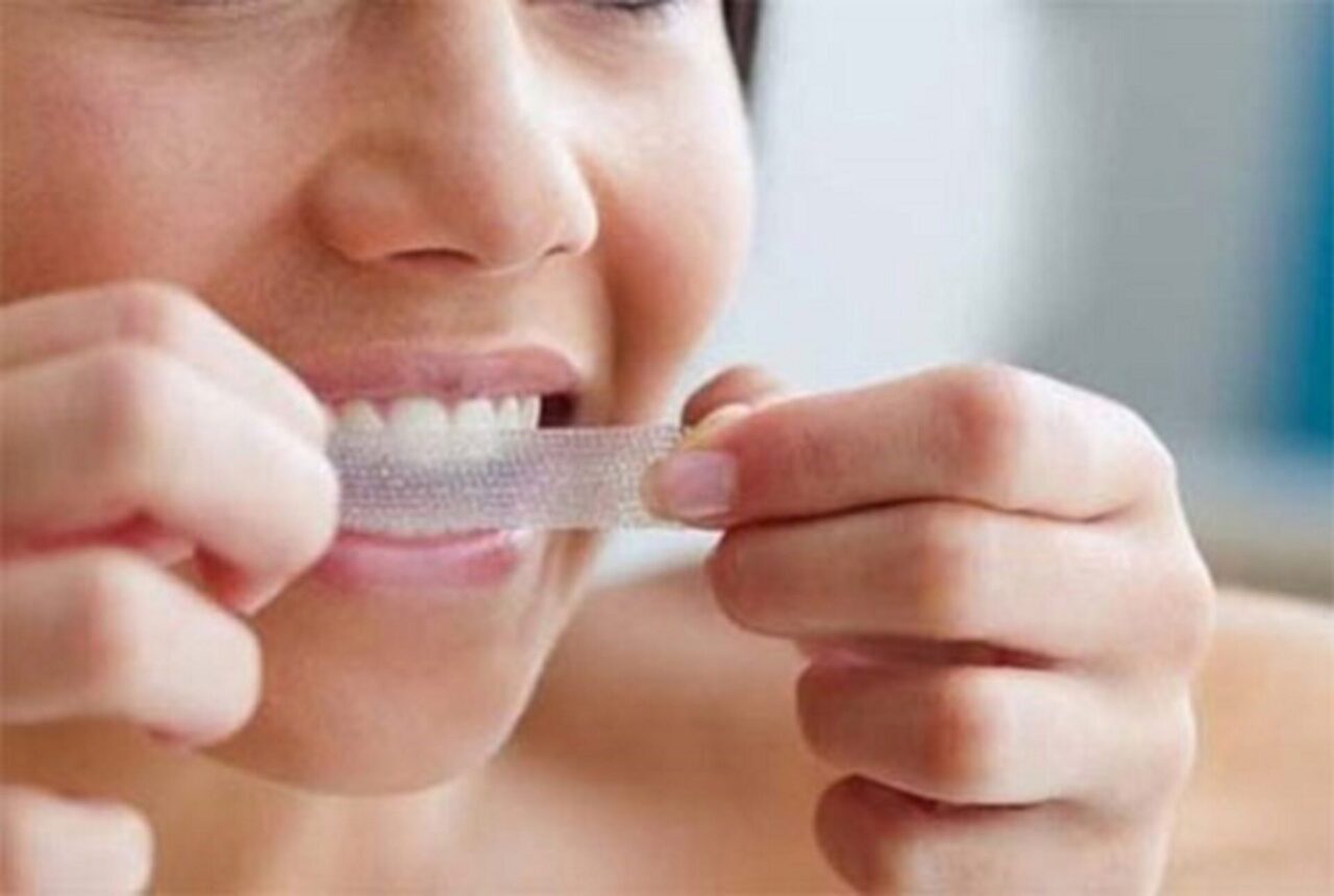 Kết quả phụ thuộc vào tình trạng màu răng ban đầu