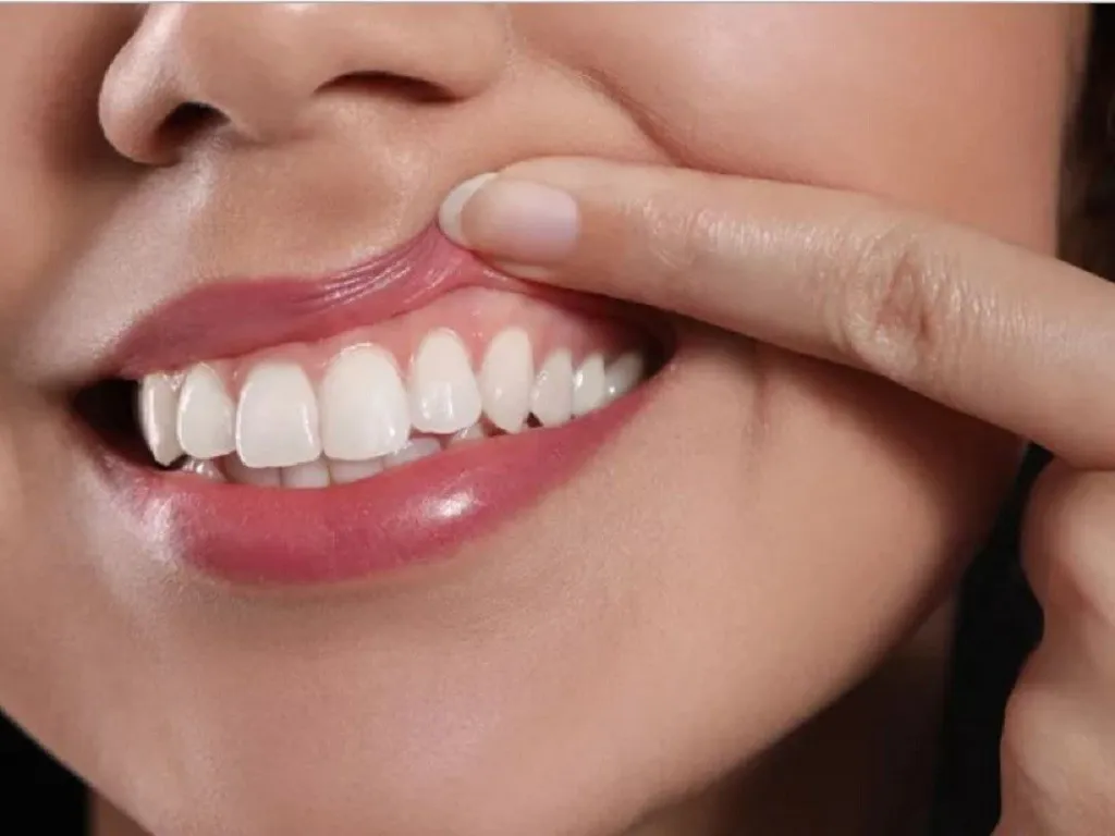 Giảm áp lực lên nướu, bảo vệ mô mềm