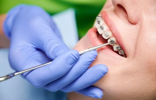 Trình độ chuyên môn và kinh nghiệm của bác sĩ chỉnh nha