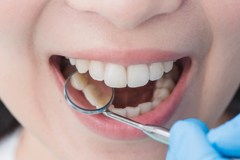 Cách điều trị dứt điểm và phòng ngừa tái phát viêm lợi nổi hạch