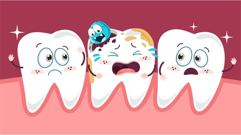 Sâu răng làm bà bầu bị viêm lợi chảy máu chân răng