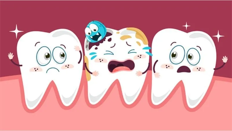 Sâu răng làm bà bầu bị viêm lợi chảy máu chân răng