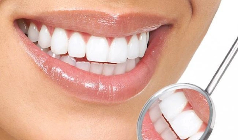 Khám răng định kỳ tại cơ sở nha khoa uy tín
