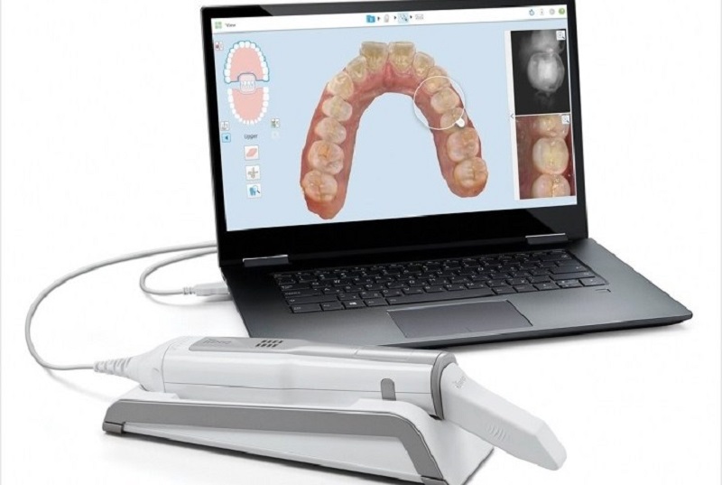 Quét 3D cấu trúc răng miệng