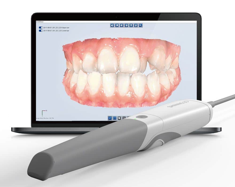 3D Intraoral Scanning – Tái tạo mô hình khoang miệng chính xác