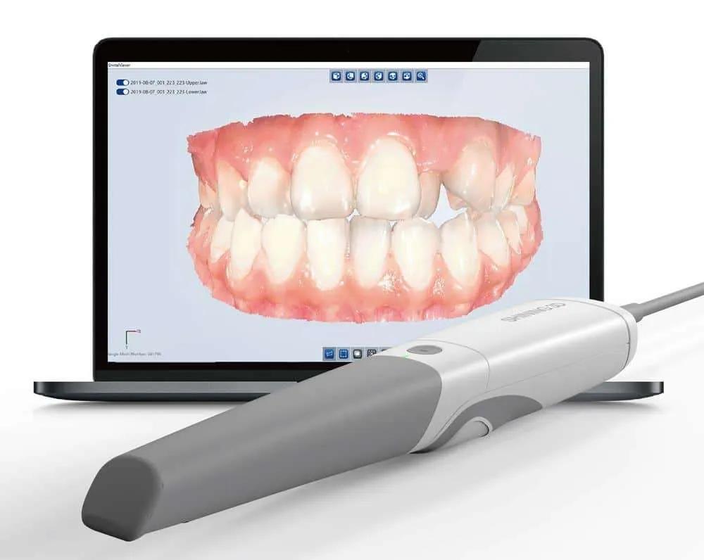 3D Intraoral Scanning – Tái tạo mô hình khoang miệng chính xác