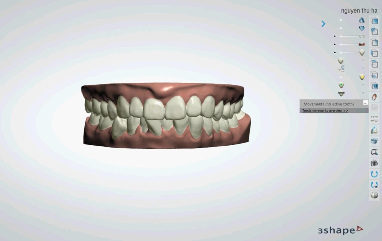 3D Simulation – Mô phỏng lộ trình bằng hình ảnh động