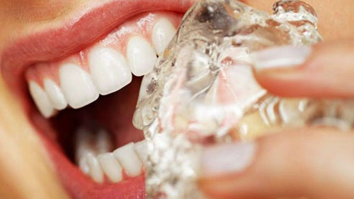 Thói quen xấu ảnh hưởng đến sức khỏe răng miệng