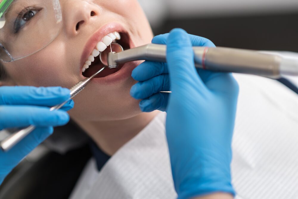 Trám răng xong bị ê buốt phải làm sao để bớt khó chịu - Cách tại nha khoa