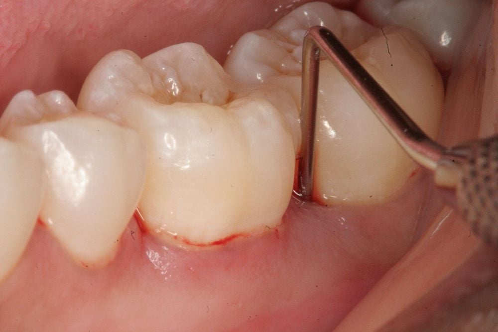 Khám răng định kỳ – Quy trình và lưu ý quan trọng cho sức khỏe răng miệng