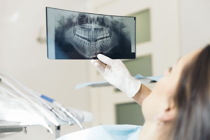 Nên khám răng định kỳ bao lâu một lần?