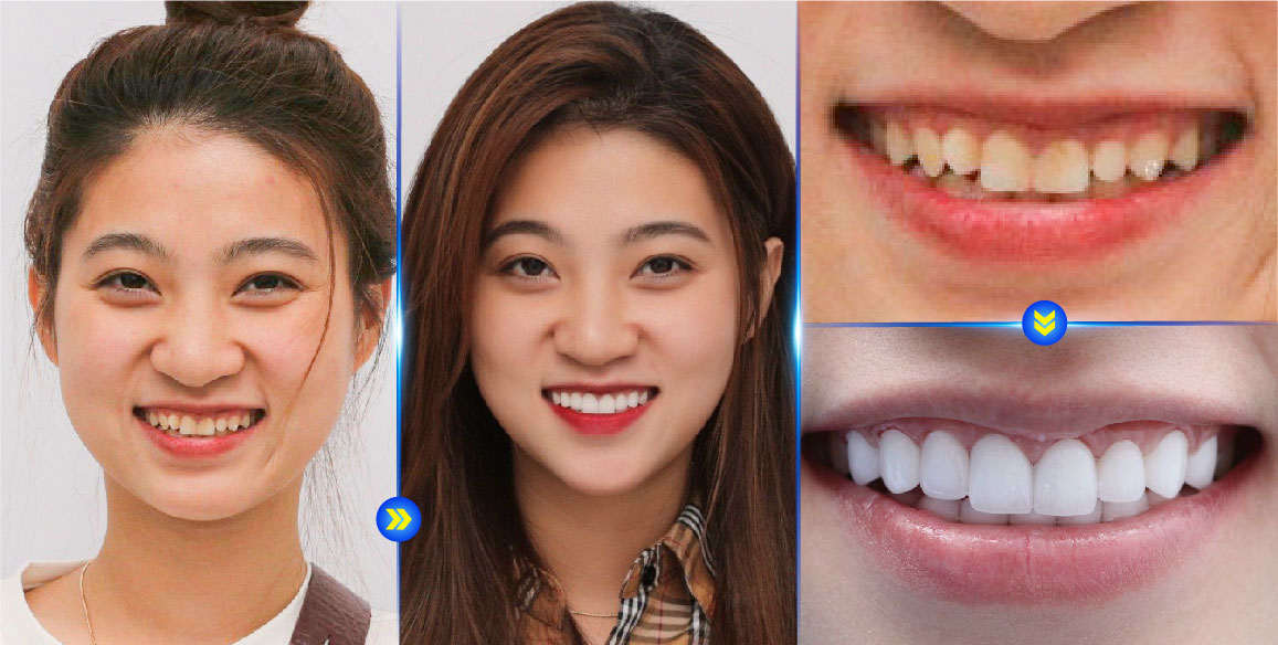 Khám răng định kỳ – Quy trình và lưu ý quan trọng cho sức khỏe răng miệng